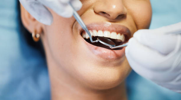 Best Emergency Dental Care for Broken or Chipped Teeth in Lake Of The Woods, VA
